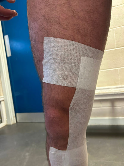 Fixation Tape